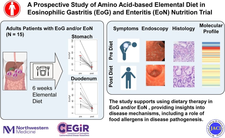 image featuring Amino Acid-Based Elemental Diet in Eosinophilic Gastritis Trial